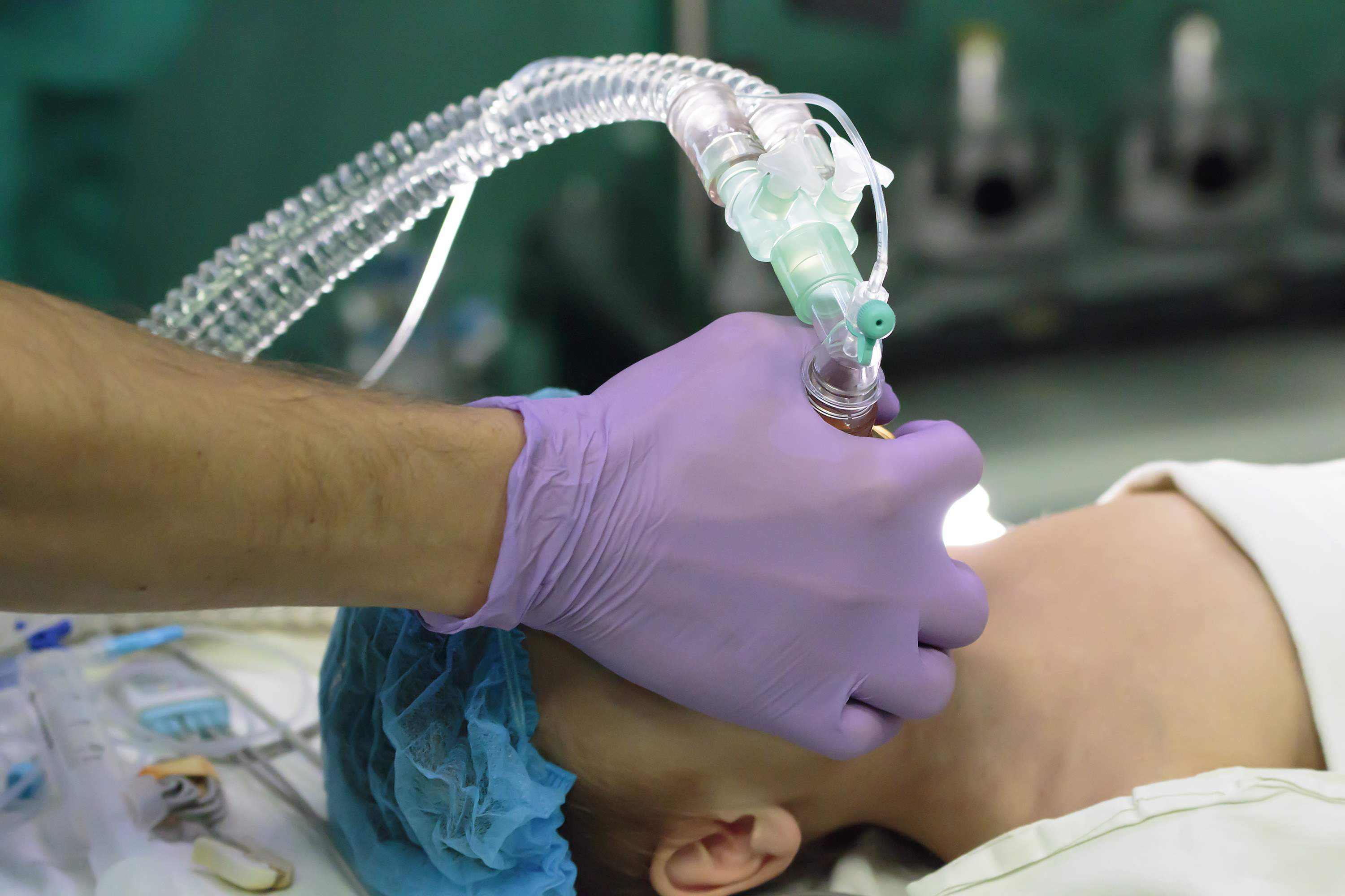 Florida Anesthesia Malpractice | Dolman Law Group