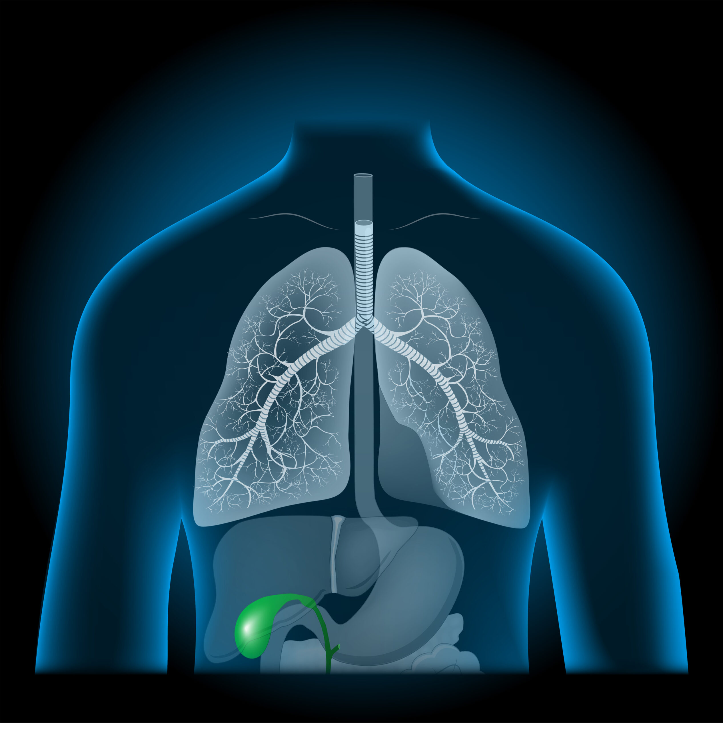 Ozempic Gallstone Lawsuits